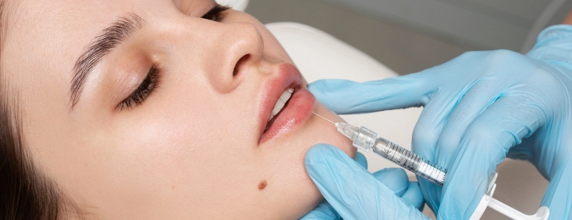 Lip Fillers 1 Before and after lip fillers at Stay Ageless Clinic NYC for fuller, natural lips.
