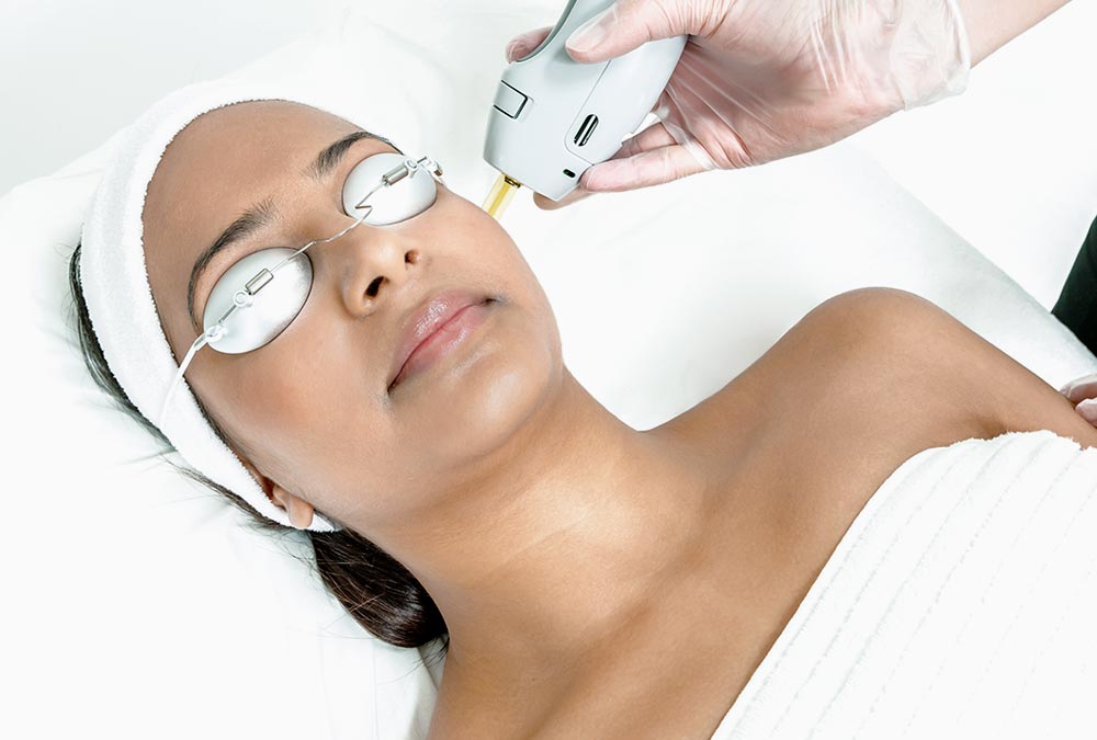 Candela laser facial treatment at Stay Ageless Clinic NYC for radiant skin