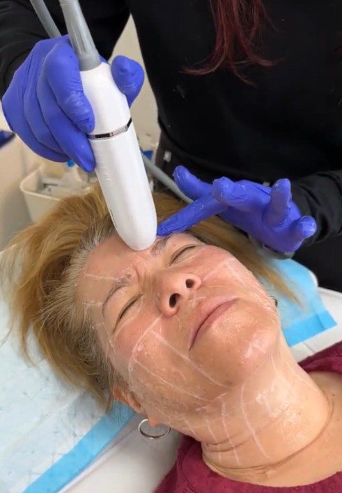 Non-Surgical Wrinkle Treatments in Center Moriches