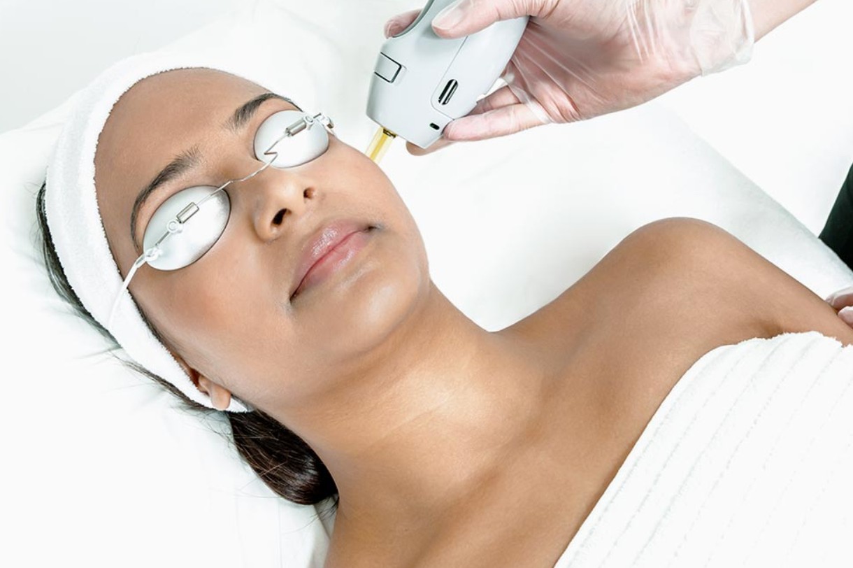 Laser Facial Treatment
