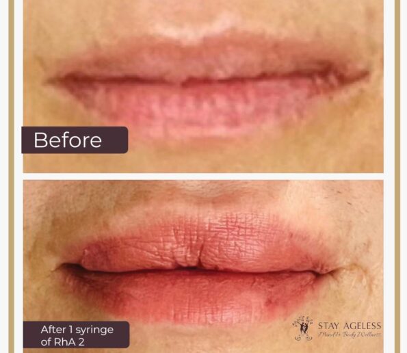 e62f2470 8101 4776 8517 cc978a1f20d7